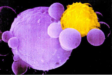 limfocit ubija celije tumora